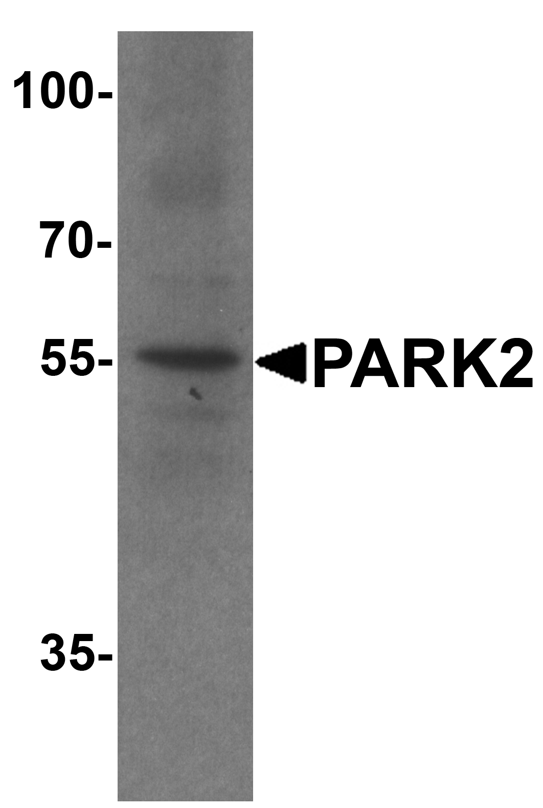 PARK2 Antibody