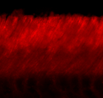 Immunohistochemical staining of adult mouse retina showing specific immunolabeling of the ABCA4 protein.  Photo courtesy of Mary Raven, University of California, Santa Barbara, CA.