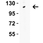 <strong>WB Validation in Human Tonsil</strong> Loading: 15 μg of human tonsil lysate. Antibodies: ATG9B 5797, 2 μg/mL , 1 h incubation at RT in 5% NFDM/TBST.Secondary: Goat Anti-Rabbit IgG HRP conjugate at 1:10000 dilution.