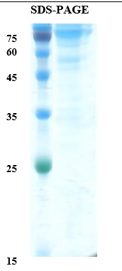 Anti-M&uuml;llerian Hormone (AMH) human Recombinant Protein