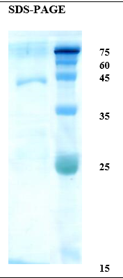 Bahia allergen Pas n 1 Recombinant Protein