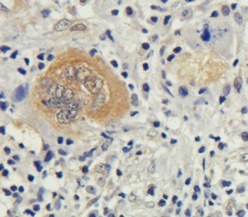 Bax (active monomer) Antibody [6A7], Rabbit IgG