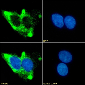 Beta 2 adrenergic receptor Antibody [13D6], Rabbit IgG