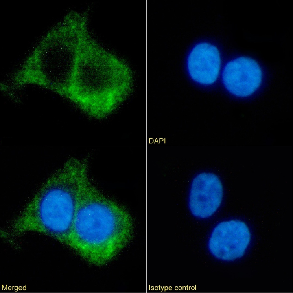 Beta 2 adrenergic receptor Antibody [R11/E1], Rabbit IgG