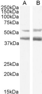 CCR4 Antibody [KW-0761 (Mogamulizumab)], Rabbit IgG - Research Grade Biosimilar