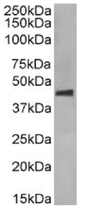 CCR5 (phosphoserine 349) Antibody [E11/19], Rabbit IgG