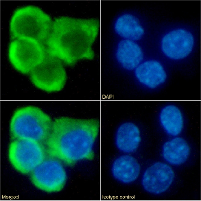 CCR7 Antibody [4B12], Rabbit IgG