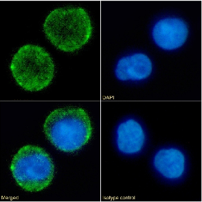CD10 Antibody [FR4D11], Rabbit IgG