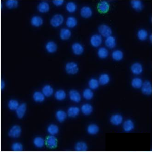 CD105 Antibody [MJ7/18], Rabbit IgG