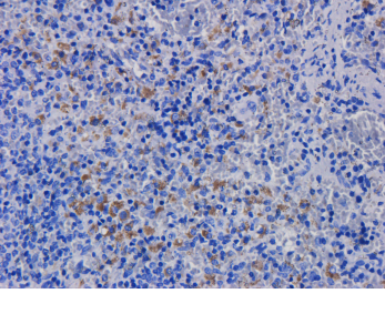 CD11a Antibody [hu1124 (Efalizumab)], Human IgG1 - Research Grade Biosimilar