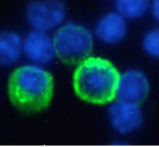 CD27 Antibody [LG.3A10], Rabbit IgG