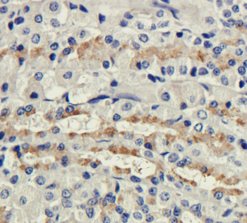 CD35 (complement receptor 1) Antibody [8C12], Rabbit IgG
