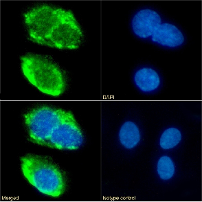 CD36 Antibody [185-1G2 (B467)], Rabbit IgG