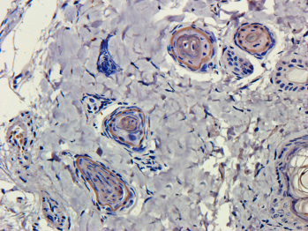 CD4 Antibody [MT310], Mouse IgG1