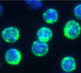 CD74 Antibody [In-1], Rabbit IgG