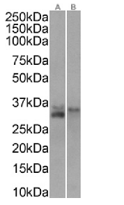 CD74 Antibody [LL1 (EPB1)], Rabbit IgG