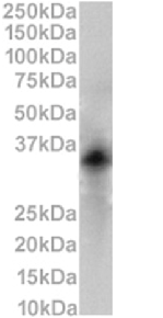 CD79b Antibody [HM79-16], Rabbit IgG