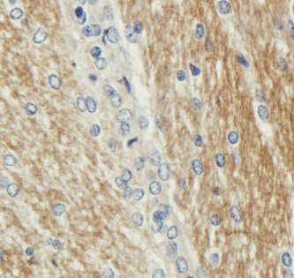 CDCrel-1 Antibody [SP18], Mouse IgG1