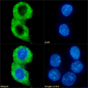 CMKLR1 Antibody [BZ194], Rabbit IgG