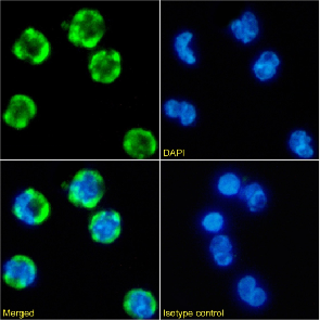 CR1 Antibody [E11], Rabbit IgG