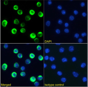 CTLA-4 Antibody [9D9], Rabbit IgG
