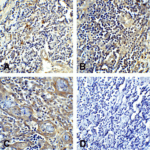 Immunohistochemistry of CTLA-4 in human tonsil tissue using (A) RF16011, (B) RF16012, (C) RF16013 and (D) control mouse IgG antibody at 5 μg/ml.