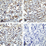 Immunohistochemistry of CTLA-4 in human lymph node tissue using (A) RF16011, (B) RF16012, (C) RF16013 and (D) control mouse IgG antibody at 5 μg/ml.