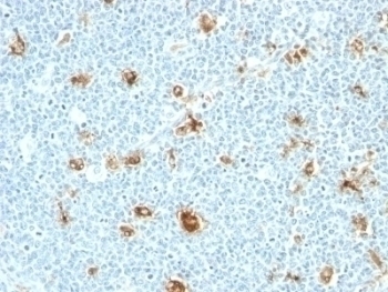 Calgranulin A + B Antibody [CAGB/426]