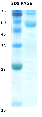 Chikungunya wild type envelope E1  Recombinant Protein