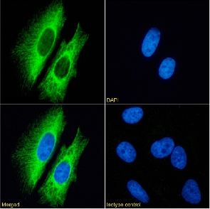 Cytokeratin 7 Antibody [OV-TL 12/30], Rabbit IgG