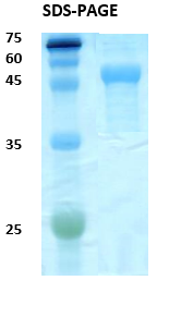 Cytomegalovirus pp 52 (UL44) Recombinant Protein