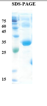 D. pteronyssinus (house dust mite) allergen Der p 1 Recombinant Protein
