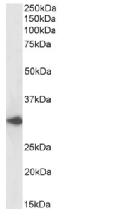 DARC Antibody [2C3], Rabbit IgG