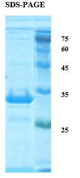 Deamidated Gliadin Peptide Antigen Recombinant Protein