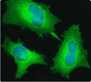 ED-B domain of fibronectin Antibody [A2], Rabbit IgG