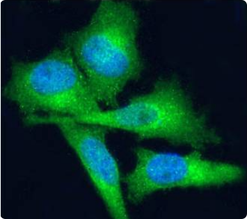 ED-B domain of fibronectin Antibody [G4], Rabbit IgG