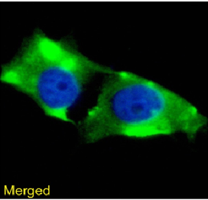ERBB2 Antibody [SAIC-02A-7], Rabbit IgG