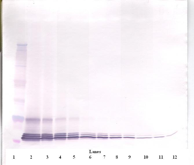 Eotaxin (CCL11) Antibody