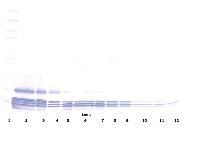 Eotaxin (CCL11) Antibody