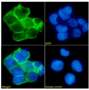 EpCAM Antibody [KS1/4], Rabbit IgG