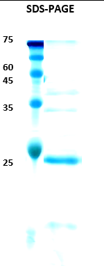 Epstein-Barr Virus (EBV) VCA p18 Recombinant Protein