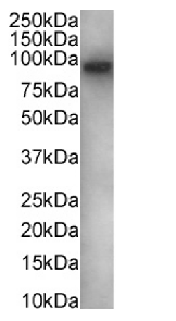 FOXP1 Antibody [RAB-S37], Rabbit IgG