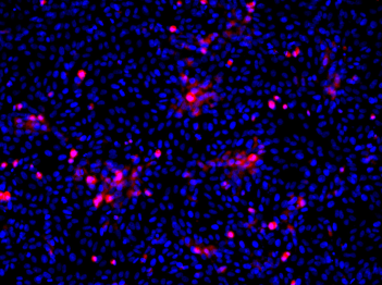 Flavivirus group antigen Antibody [D1-4G2-4-15 (4G2)], Rabbit IgG
