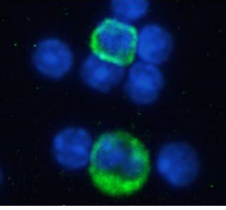 GITR Antibody [YGITR 860.103.5], Rabbit IgG