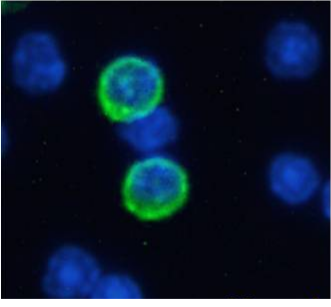 GITR Antibody [YGITR765], Rabbit IgG