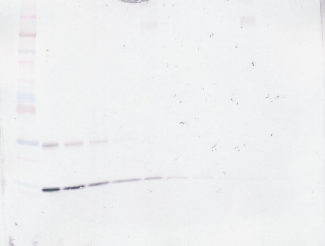 GM-CSF Antibody