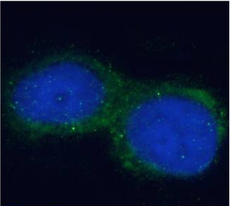 GM2 ganglioside Antibody [L55-81], Rabbit IgG