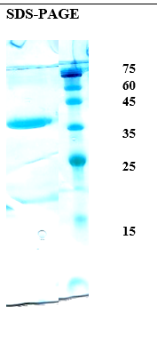German Cockroach allergen Bla g 2 Recombinant Protein