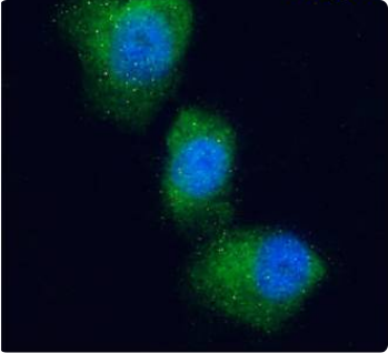 Glucose-dependent insulinotropic Receptor Antibody [Gipg013], Rabbit IgG