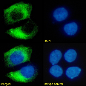HER2/neu Antibody [SER4], Mouse IgG1